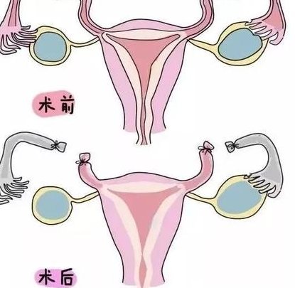 移植三天和六天的囊胚是不是一样的？发育潜力差异不能忽略